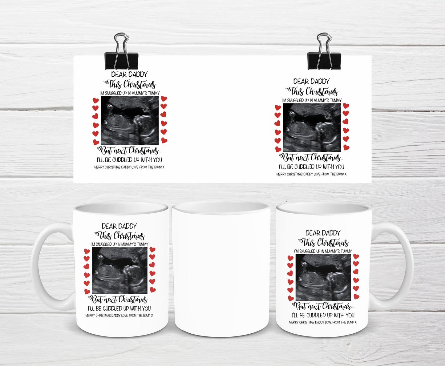 Daddy To Be Scan Photo Mug | Christmas Bump Mug | Gift Idea