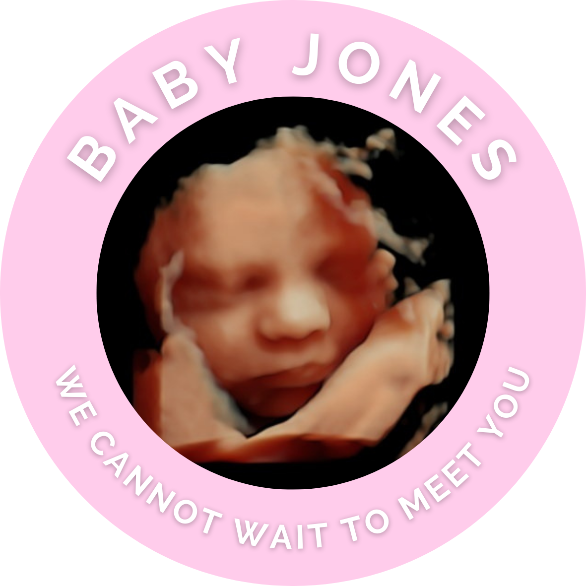 Pink Personalised Scan Photo Stickers | Various Sizes | Baby Shower Party Stickers | Event Stickers