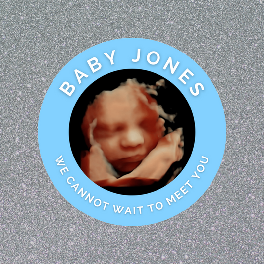 Blue Personalised Scan Photo Stickers | Various Sizes | Baby Shower Party Stickers | Event Stickers