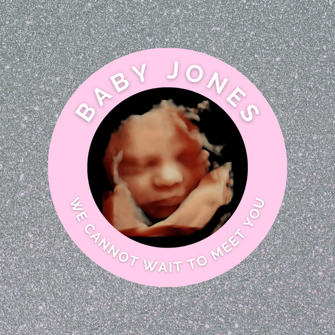 Pink Personalised Scan Photo Stickers | Various Sizes | Baby Shower Party Stickers | Event Stickers