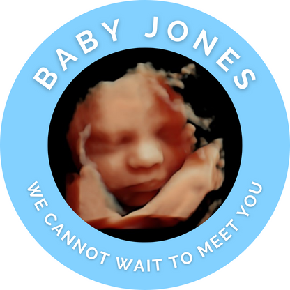 Blue Personalised Scan Photo Stickers | Various Sizes | Baby Shower Party Stickers | Event Stickers