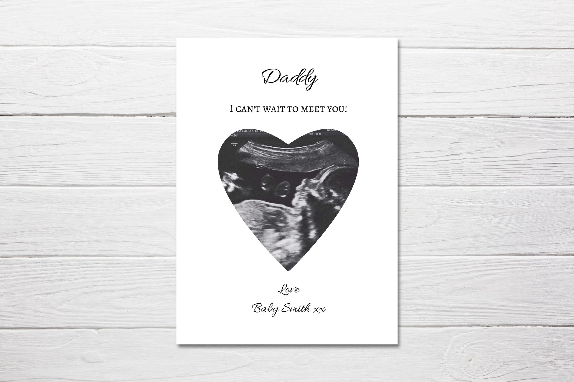 Fathers Day Card | Daddy Scan Photo Card | Daddy to be Card - Dinky Designs